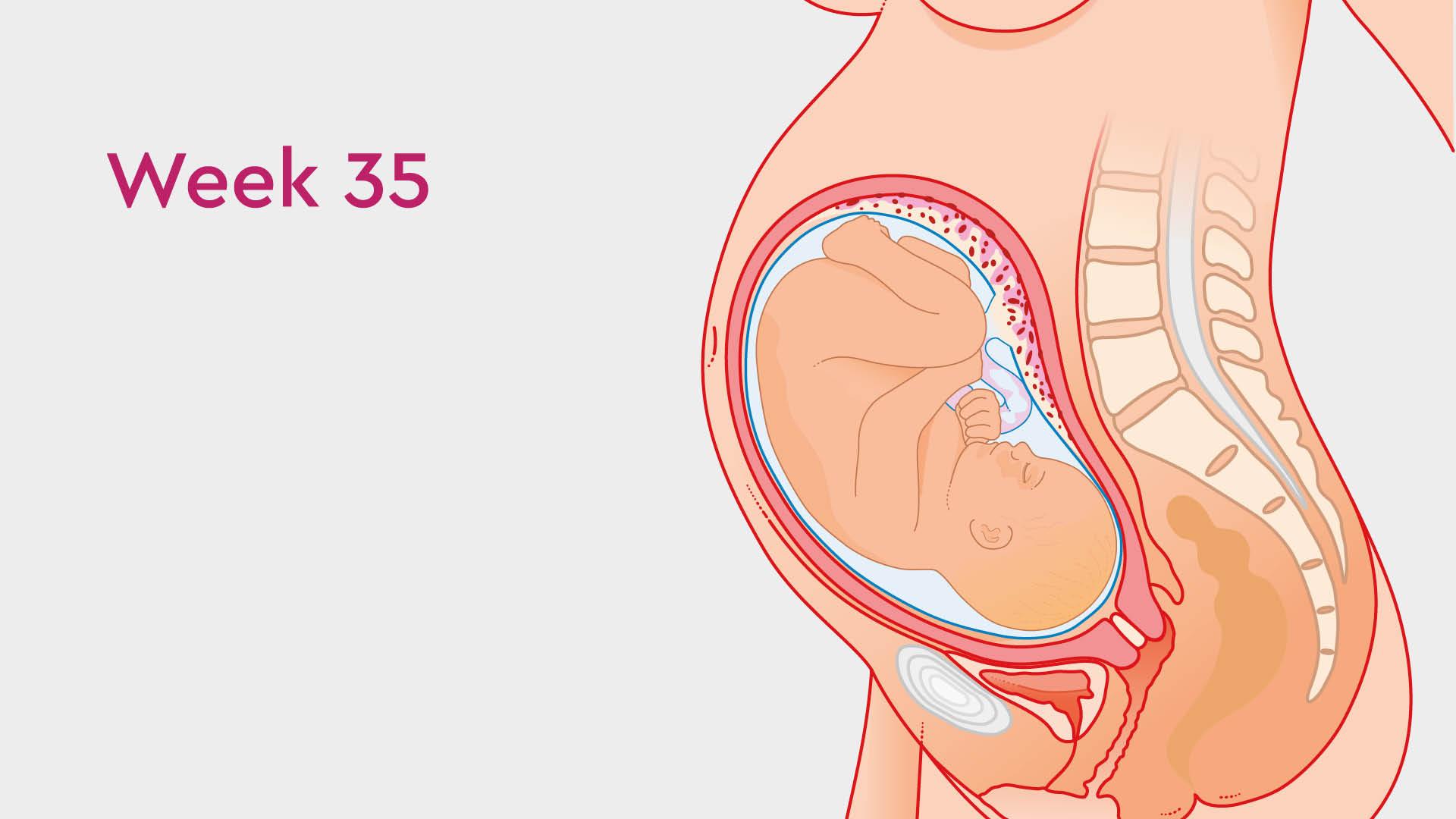 35 Weeks Pregnant Symptoms Cramps Things to Avoid